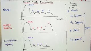 Serum Protein Electrophoresis importance and result interpretation in an easy way [upl. by Gunnar]