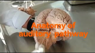 Neuroanatomy  Auditory pathway anatomy of auditory tract [upl. by Lertnahs372]