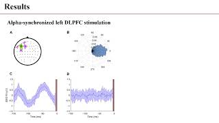 저널미팅 Brain synchrotim of the left DLPFC cortex in depression using realtime EEGtriggered TMS [upl. by Mccreery388]