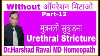 urethral stricture  Cause sine symptoms homeopathy medicine and homeopathic remedy [upl. by Azeel]