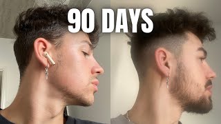 How To GROW A BEARD In 90 Days Using MINOXIDIL amp DERMA ROLLER [upl. by Chura]