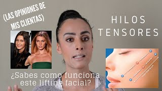 Hilos tensores para el tratamiento facial [upl. by Juanne580]