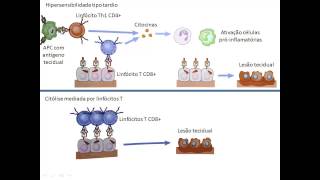 Hipersensibilidades 45 Tipo IV  mediada por linfócitos T [upl. by Leif]
