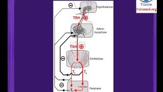 Hypothyroidie comment reconnaitre goitre debutant Glande thyroïdienne nodulaire symptomes nodule [upl. by Atiker]