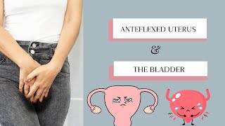 Anteflexed Uterus [upl. by Anniroc]