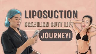 Liposuction BBL Experience  Lynell Lopez [upl. by Anna-Diane452]