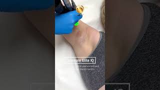 Laser Hair Removal Cynosure Elite IQ [upl. by Lateehs139]