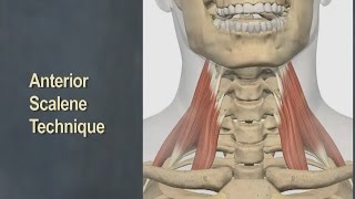 Therapeutic Massage for Anterior Scalene Muscles [upl. by Smailliw313]