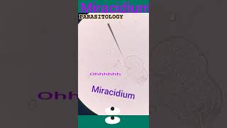 Miracidium of schistosoma mansoniSchistosomiasisParasitic worm disease👍Parasitology👍🔬✅ [upl. by Nomor]