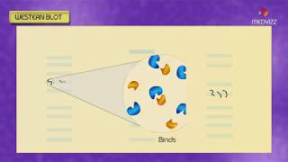 Western blot  Southern blot  Northern blot  South western Blot  Animation [upl. by Palla849]