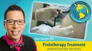 Platelet Rich Plasma PRP Prolotherapy Injections to a Knee [upl. by Hpesoj]