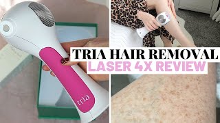 TRIA HAIR REMOVAL LASER 4X REVIEW DEMO amp 6 MONTH RESULTS [upl. by Udenihc]