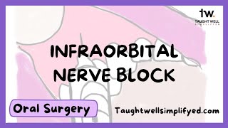 INFRAORBITAL NERVE BLOCK TECHNIQUE  Tips for finding the infraorbital foramen [upl. by Enaira673]