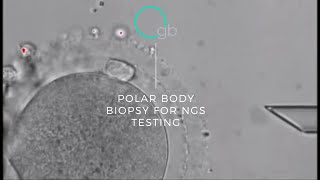 Polar Body biopsy for NGS testing [upl. by Theola]