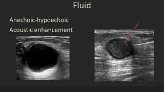 Ultrasound 101 Part 5 Terminology and Tissuesmp4 [upl. by Aicilla96]