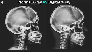 The Magic of Xrays How They Work and Create Images in Digital Radiography and Radiographic Films [upl. by Tebazile494]