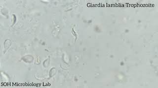 Giardia lamblia Trophozoite in stool [upl. by Laup]