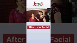 Transforming Skin with HydraFacial  Real Results and Benefits  Juvena Herbals [upl. by Nnaj773]