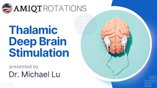 Michael Lu Thalamic Deep Brain Stimulation for Closed Head injury [upl. by Anirbac776]