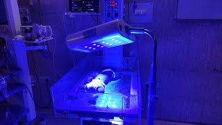 Phototherapy Treatment For Jaundice  Phototherapy In Newborn [upl. by Lubbi]