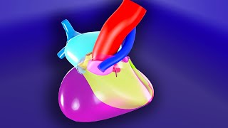 Tetralogy of Fallot  3D Animated Visual Lecture [upl. by Adnawyt961]