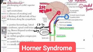 Horner Syndrome Causes Symptoms amp Treatment ophthalmology 26  First Aid USMLE Step 1 [upl. by Kostival]