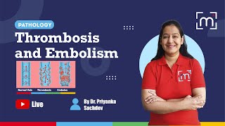 Thrombosis and Embolism with Dr Priyanka Sachdev [upl. by Niletac115]