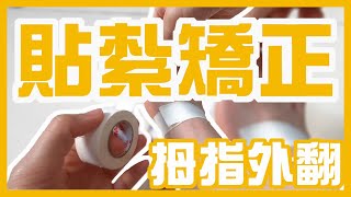 拇指外翻自我貼紮｜3M膠布也可以？運動貼紮固定你的拇指外翻！安心無痛跑步，不再讓疼痛打擾你！ [upl. by Neenej385]