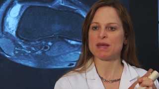 Dr Sabrina Strickland explains Patellar Dislocation and MPFL Reconstruction [upl. by Niwri218]