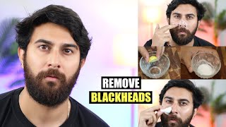 How to Remove Blackheads From Nose amp Face  Home Remedies [upl. by Rida]