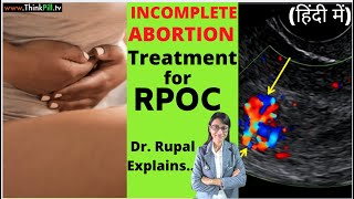 Incomplete Abortion😞 Dr Plz  Give Treatment for RPOC Hindi LadiesHealth [upl. by Beatrix]