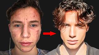 Ugly Guy Glows Up And Becomes Calvin Klein Model full method explained [upl. by Olrak848]