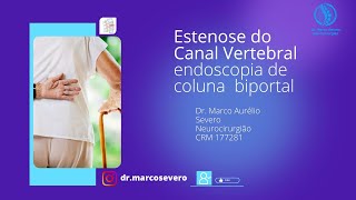 Estenose do canal vertebral e hérnia de disco lombar tratadas com endoscopia de coluna biportal [upl. by Carter]