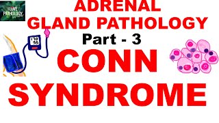 Adrenal Gland Pathology Part 3 HYPERALDOSTERONISM CONN SYNDROME [upl. by Ardnatal246]