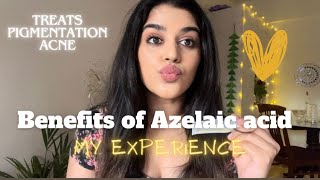 Benefits of Azelaic acid My experience with Azelaic acidAzelaic acid for acne amp Pigmentation acne [upl. by Ffirahs603]