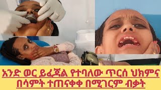 How can we treat our teeth in Ethiopiaበ ኢትዮጵያ እንዴት ጥርሳችንን ማሰራት መታከም እንችላለን [upl. by Danuloff463]