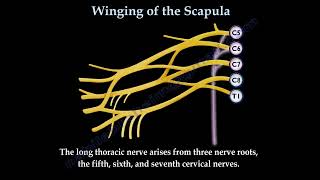 WINGING OF THE SCAPULALONG THORACIC NERVE  Everything You Need To Know  Dr Nabil Ebraheim [upl. by Vareck899]