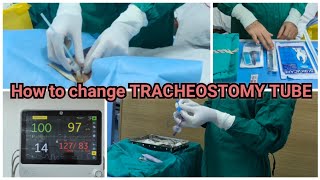 How to change TRACHEOSTOMY TUBE Sir Ganga Ram hospital nursing medicalschool [upl. by Aldas]