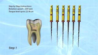 HYFLEX CM Key Features [upl. by Lirrad]