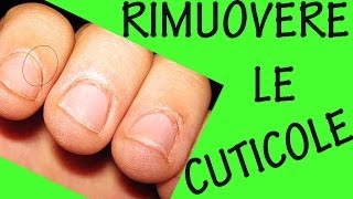 COME RIMUOVERE LE CUTICOLE Sos unghie 9 [upl. by Leimaj]