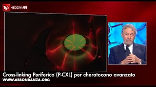 Intervento cheratocono avanzato PCXL  Dr Abbondanza al Tg2 [upl. by Drahcir130]