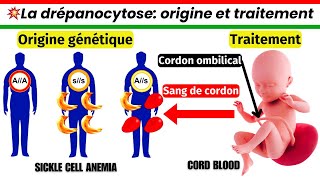 Origine génétique de la drépanocytose et son traitement par les cellules souches du cordon ombilical [upl. by Chevalier3]