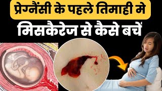 पहली तिमाही में मिसकैरेज से कैसे बचेHow to get pregnant naturallypregnancy tips [upl. by Valer264]