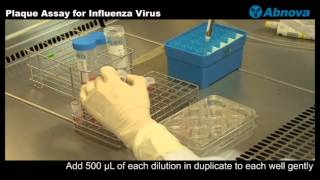 Plaque Assay for Influenza Virus [upl. by Nelyak]