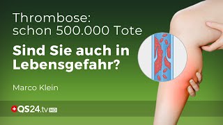 Thrombose – Prophylaxe und Behandlung  Kleinsche Felder  Marco Klein  QS24 Gesundheitsfernsehen [upl. by Madella]