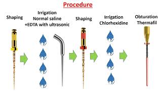 Healing of two separate lesions associated with a lateral canal by routine endodontic treatment [upl. by Wiedmann542]