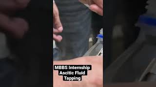 MBBS Intership  Ascitic Fluid Tapping  DrGarima  MisMedicine shorts viral shortvideos [upl. by Anyah703]