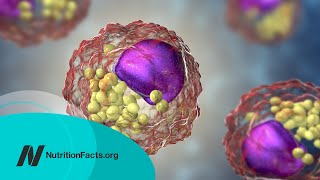 How Low Should You Go for Ideal LDL Cholesterol [upl. by Llerdnad235]