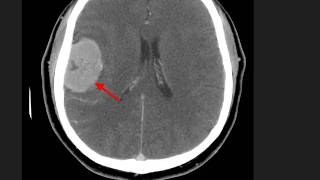 High Yield CT Scans Part 2  USMLE [upl. by Perlis49]