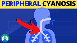 Peripheral Cyanosis Medical Definition  Quick Explainer Video [upl. by Ahsaeyt156]